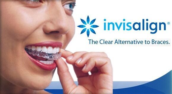 logo-invisalign_0